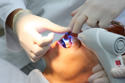 Lesioni dolose: falso dentista cagiona al paziente postumi in...