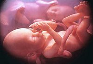 L'indennità di maternità nell'ipotesi di parto (o ado...