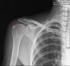Negligenza in fase diagnostica. Se il medico avesse fatto due...