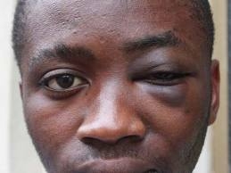 ‘Nonnismo’ a scuola ai danni di un ragazzo nigeriano che vie...