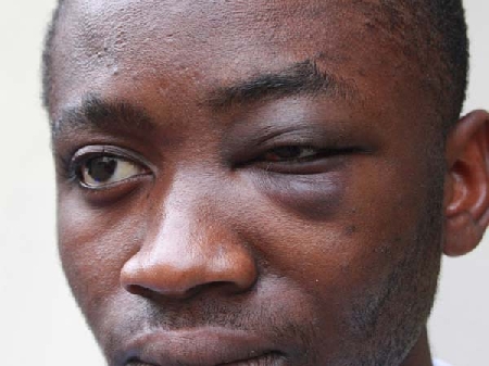 “Sporco negro”: riconosciuta l'aggravante della discriminazio...