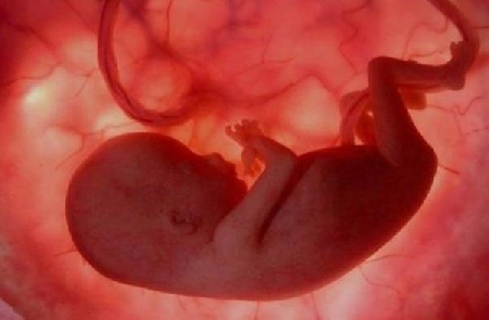 Secondo il padre, la madre si sarebbe procurata la gravidanza...
