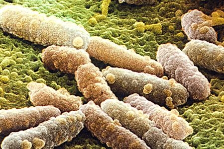 Escherichia coli 3 Luglio 2011 Situazione sotto controllo