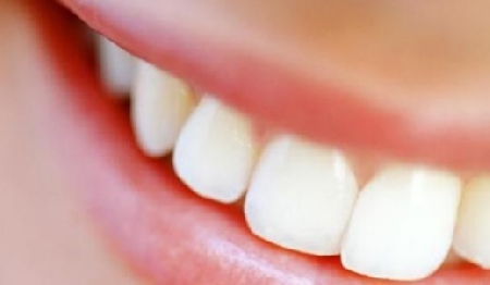 Lamenta danni derivanti da una protesi dell'arcata dentaria s...